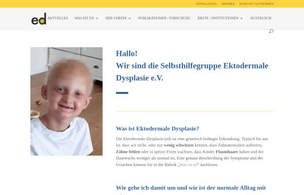 Vorschau von www.ektodermale-dysplasie.de, Selbsthilfegruppe Ektodermale Dysplasie