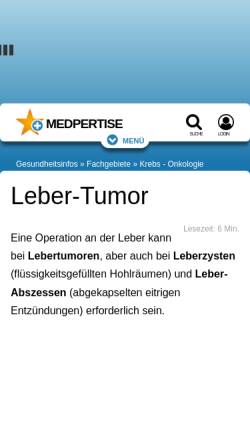Vorschau der mobilen Webseite www.chirurgie-portal.de, Lebertumore