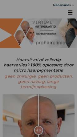 Vorschau der mobilen Webseite www.prohairclinic.com, Prohair Klinik in Belgien