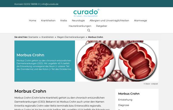 Vorschau von www.curado.de, Morbus Crohn
