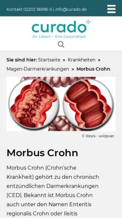 Vorschau der mobilen Webseite www.curado.de, Morbus Crohn