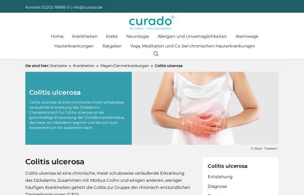 Vorschau von www.curado.de, Was ist Colitis ulcerosa?