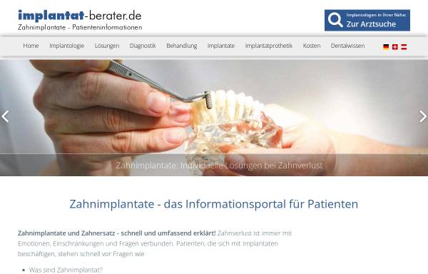 Vorschau von www.implantat-berater.de, Implantat-berater.de