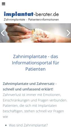 Vorschau der mobilen Webseite www.implantat-berater.de, Implantat-berater.de