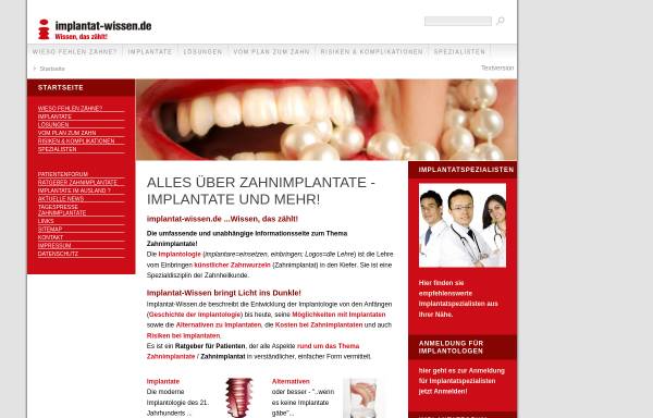 Vorschau von implantat-wissen.de, Implantat-Wissen: Patientenratgeber zum Thema Zahnimplantate