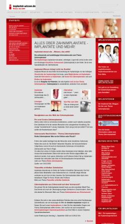 Vorschau der mobilen Webseite implantat-wissen.de, Implantat-Wissen: Patientenratgeber zum Thema Zahnimplantate