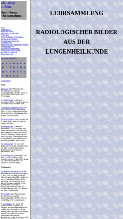 Vorschau der mobilen Webseite www.mevis-research.de, Die Lunge im Netz