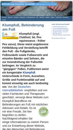 Vorschau der mobilen Webseite www.klumpfuesse.de, Klumpfuß - Ratgeber und Wegweiser