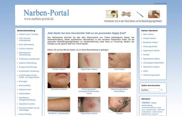 Das Narben-Portal