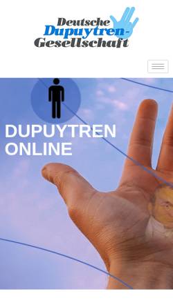 Vorschau der mobilen Webseite www.dupuytren-online.de, Dupuytren e.V.