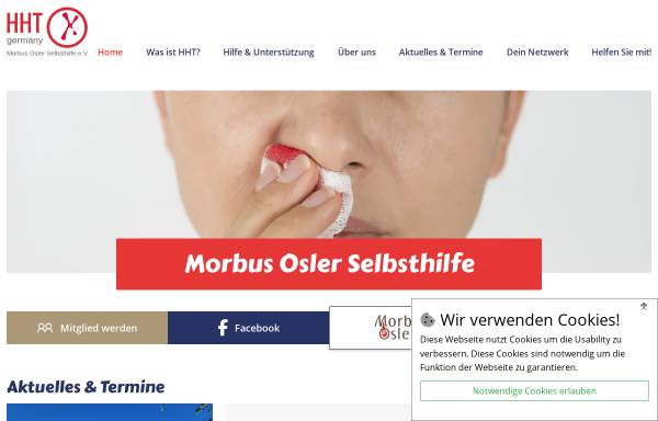 Vorschau von www.morbus-osler.de, Morbus Osler Selbsthilfe e.V.