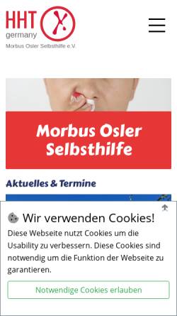 Vorschau der mobilen Webseite www.morbus-osler.de, Morbus Osler Selbsthilfe e.V.