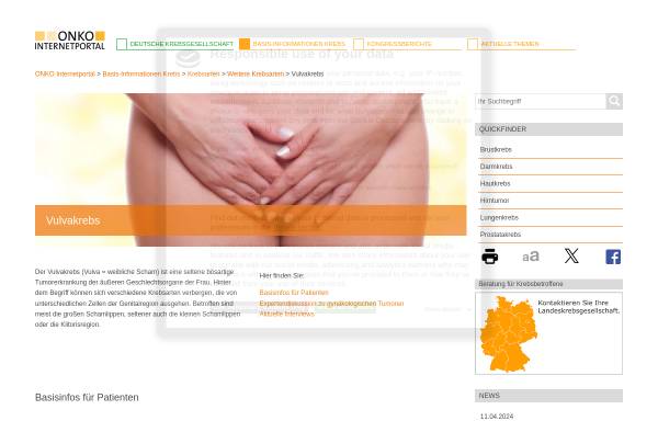 Vorschau von www.krebsgesellschaft.de, Vulvakrebs