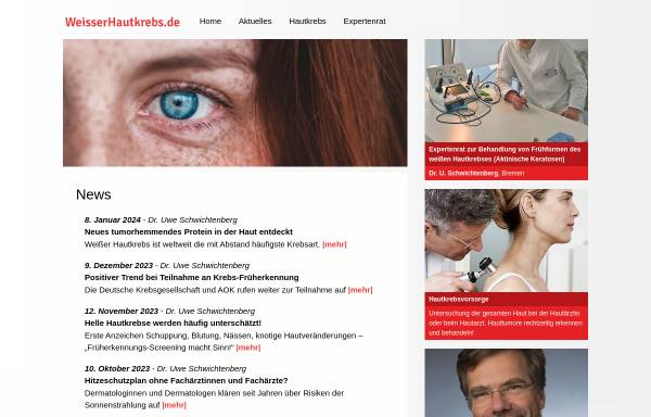 Vorschau von www.weisserhautkrebs.de, Initiative Weißer Hautkrebs