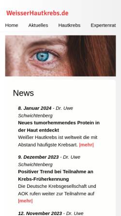 Vorschau der mobilen Webseite www.weisserhautkrebs.de, Initiative Weißer Hautkrebs