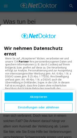 Vorschau der mobilen Webseite www.netdoktor.de, Erste Hilfe bei Verbrennungen und Verbrühungen