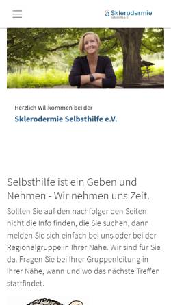 Vorschau der mobilen Webseite www.sklerodermie-selbsthilfe.de, Sklerodermie Selbsthilfe e.V.